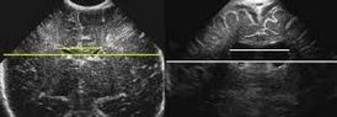 ultrasound image