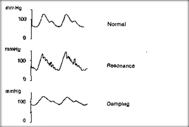 Diagram of Blood Pressure Monitoring Traces