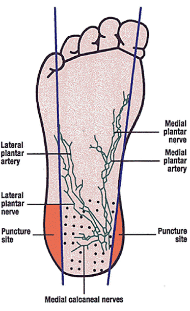 Capilliary sampling site diagram of the foot