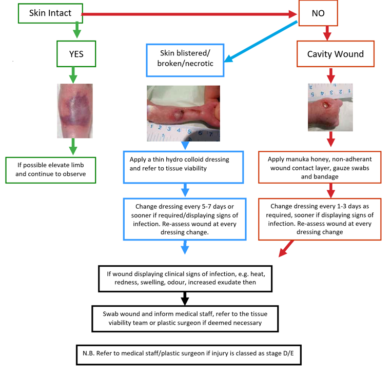 Flowchart for extravasation injury wound management