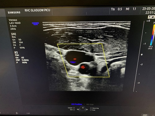 Example image