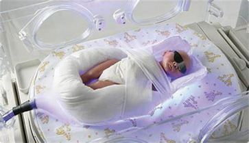 phototherapy for jaundice