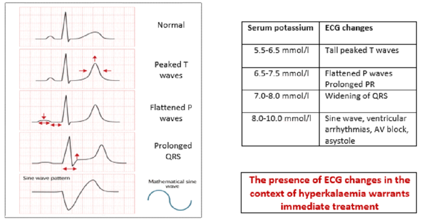 The reported mortality of neonates with hyperkalaemia is high even with treatment