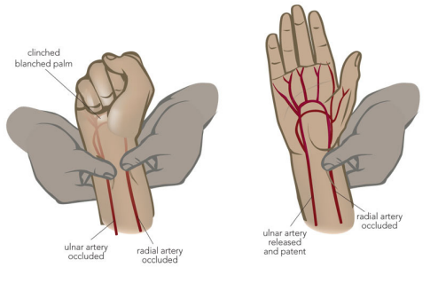 Image showing Allen's Test